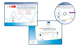 ecocardiograma y ecg
